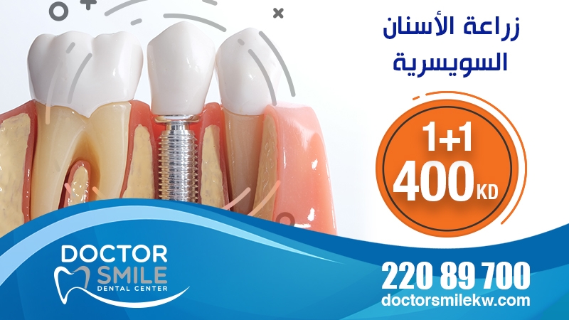 Dental Implant February Promotion